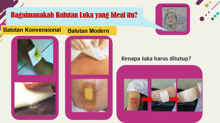 Bagaimakah Balutan Luka yang Ideal itu_alineaku
