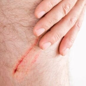 Luka yang Tak Terlihat_alineaku